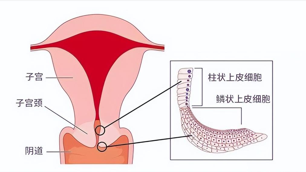 多数人感染HPV后两年内可自愈